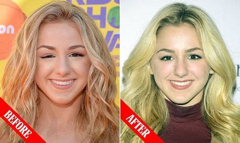 what is chloe lukasiak medical condition